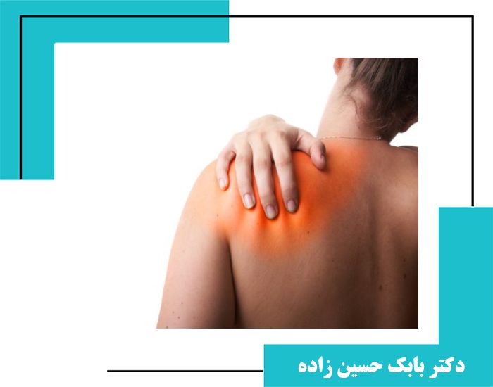علائم، علل و روش‌های درمان شانه یخ زده در تهران