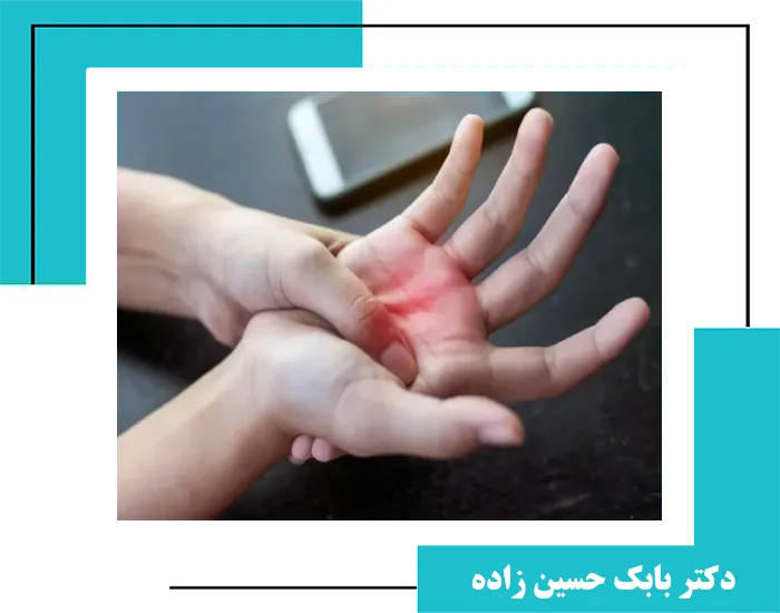 10 تمرین برای مشکل تنگی کانال مچ دست cts